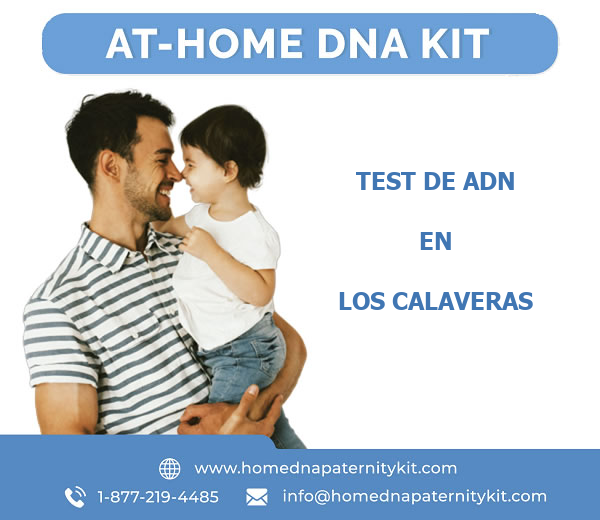 Test de ADN en Los Calaveras